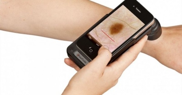 DermoScreen, una app para comprobar tu riesgo de tener cáncer de piel