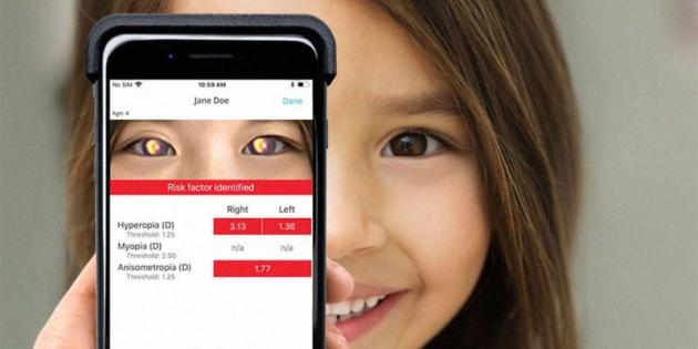 Una app permite detectar problemas de visión y enfermedades oculares en niños