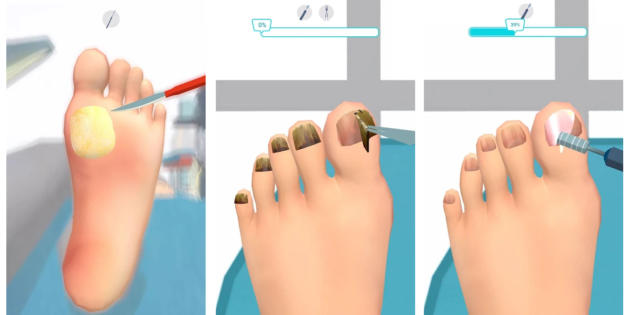 Foot Clinic- ASMR Feet Care, el juego del podólogo que triunfa en Google Play