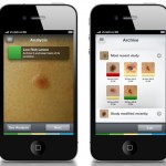Los médicos advierten que las apps móviles no pueden detectar el cáncer de piel