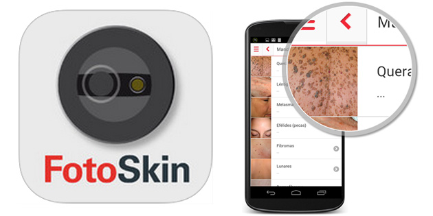Nace FotoSkin, una aplicación que ayuda a prevenir el cáncer de piel