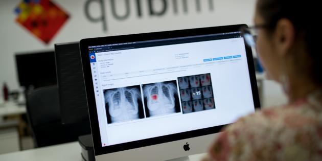La startup médica Quibim cierra una ronda de 8 millones de euros