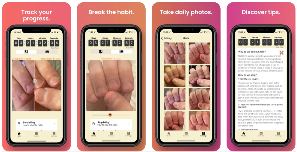 NailKeeper, la app que te ayuda a dejar de morderte las uñas