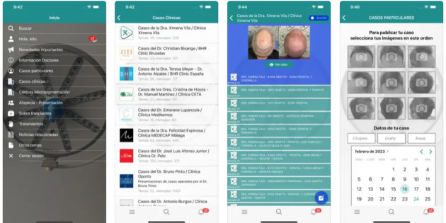 Injerto capilar, una app para que lo conozcas todo sobre los trasplantes de pelo