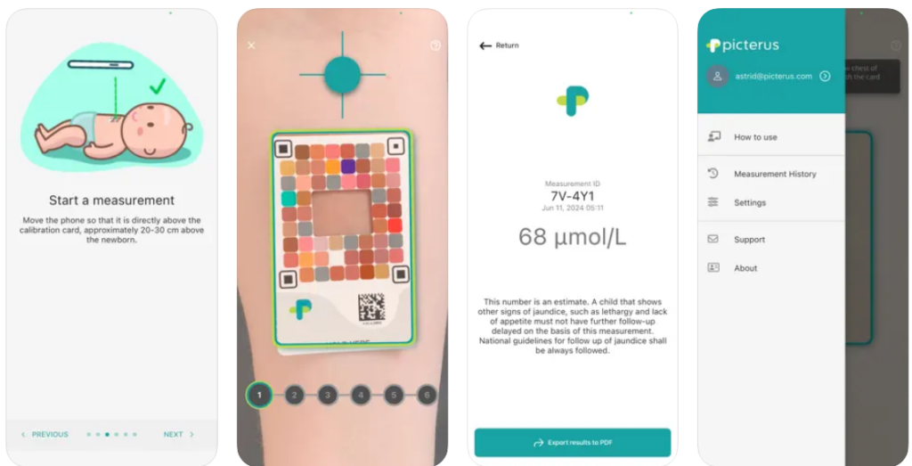 Una app permite identificar ictericia en recién nacidos